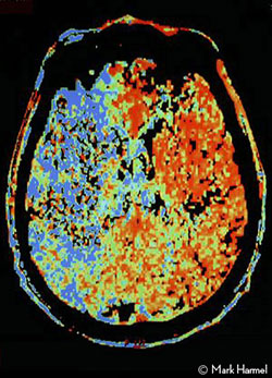 Brain Imaging