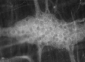 Gut Nerve Damage